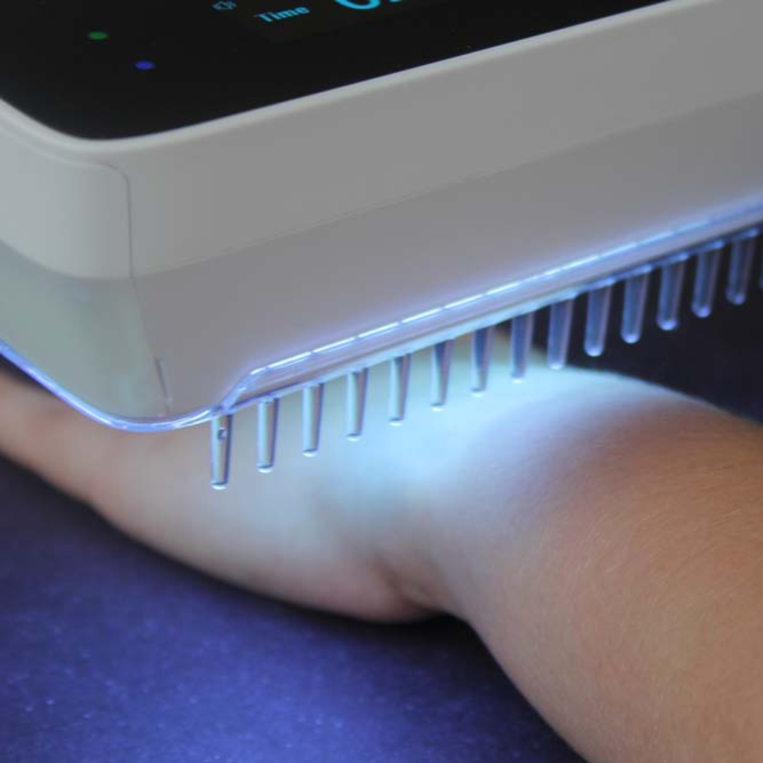 "Compact handheld UVB phototherapy lamp for psoriasis, vitiligo treatment; ideal for scalp, hands, joints; travel-friendly."