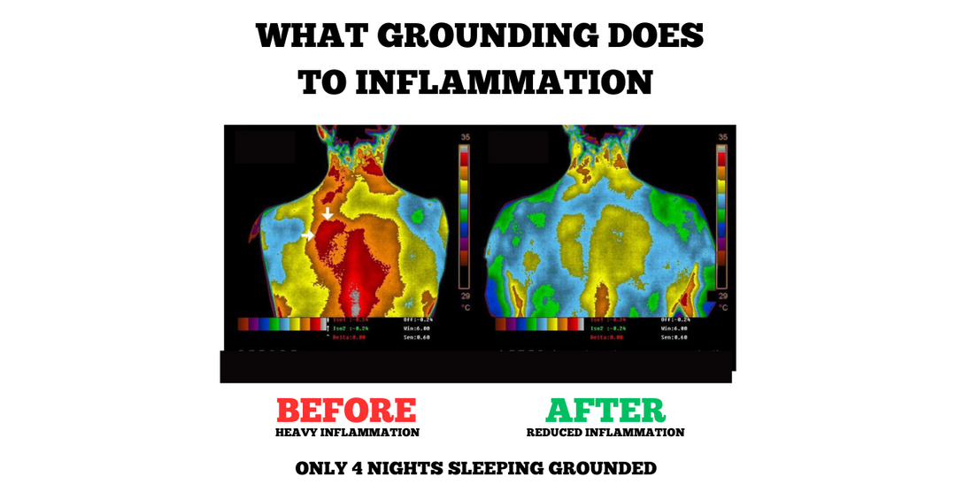 Grounding sleep mat for enhanced sleep. Carbon-infused leatherette material, under-sheet design for natural energy balance.