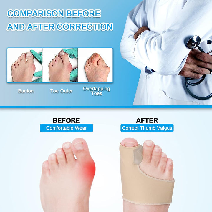 "Unisex bunion relief silicone corrector with gel padding, offers pain relief and toe alignment with durable medical grade si