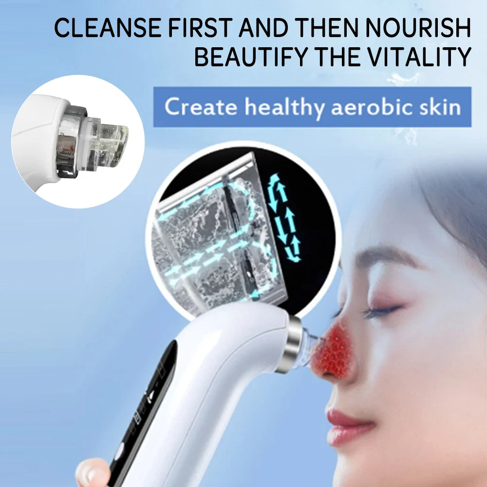 "Unisex electric blackhead remover vacuum, sleek design, adjustable suction for skin cleansing, front view."